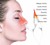 Terapia laserowa nosa